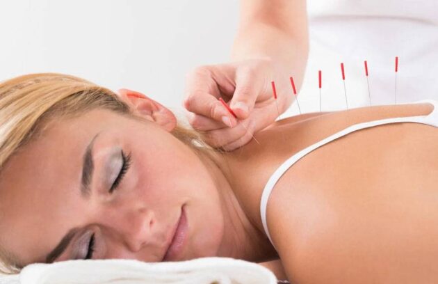 درای نیدلینگ _ سوزن خشک