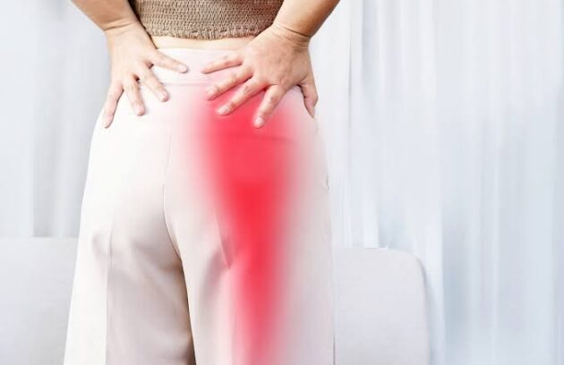 sciatica-سیاتیک