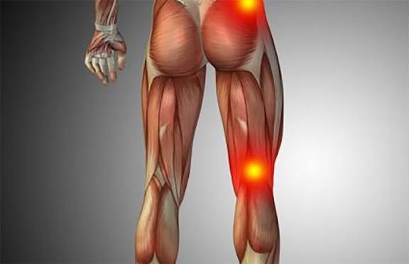 sciatica-سیاتیک